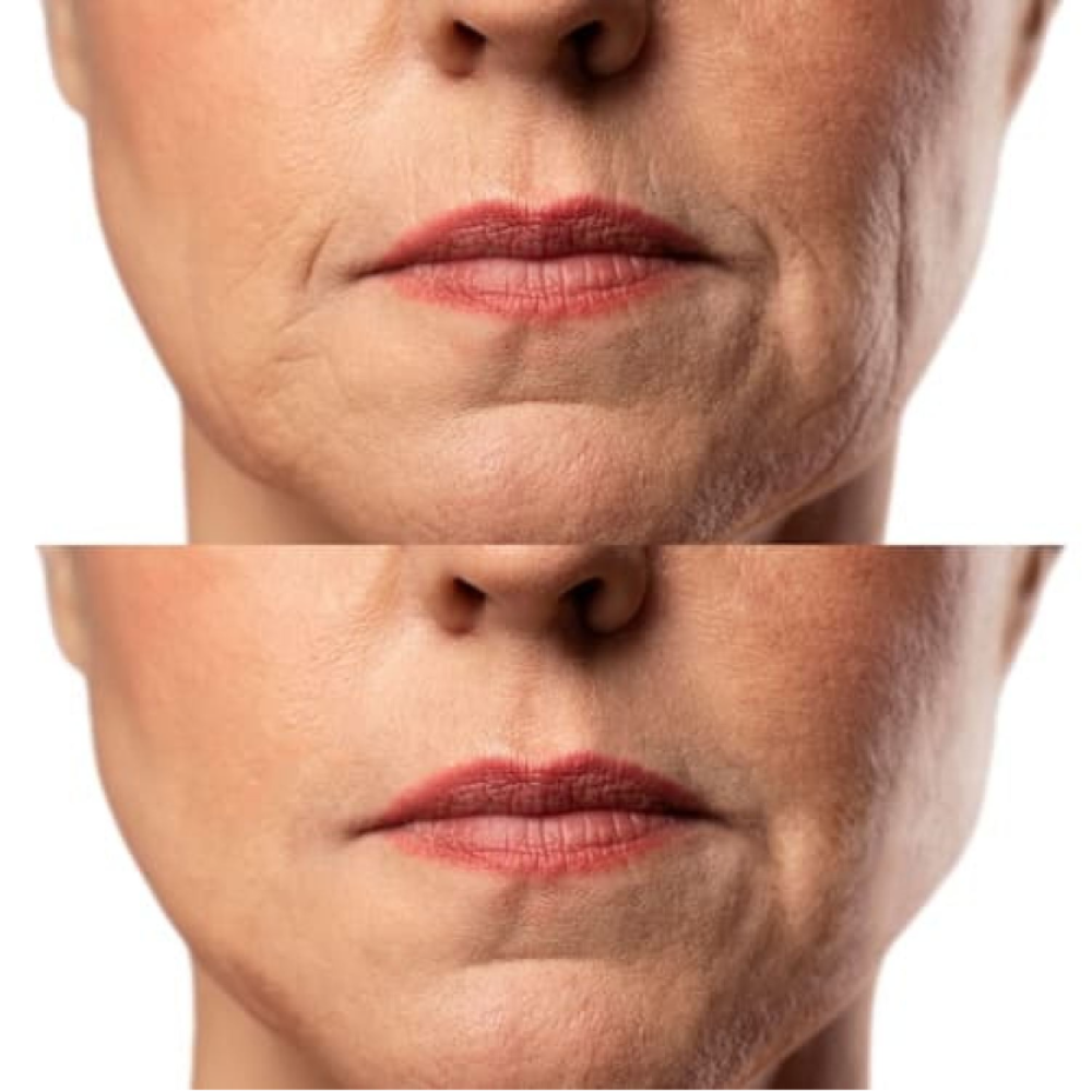 Mikroprądowy masażer do liftingu twarzy Skin Lifting 7.0 White – EMS, LED (Japonia)