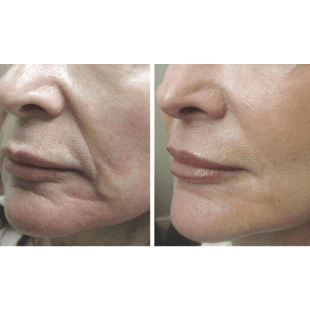 Mikroprądowy masażer liftingujący MEDICA+ Skin Lifting 5.0 (Japonia)